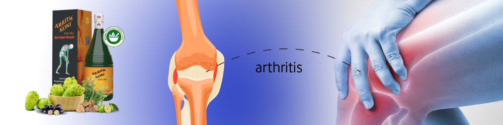 arthritis causes and treatment