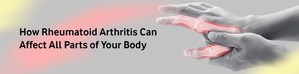 How Rheumatoid Arthritis Can Affect All Parts of Your Body