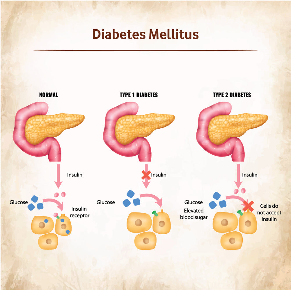 
                  
                    Blood glucose monitor for managing diabetes mellitus
                  
                